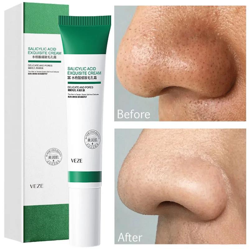 Salicylic Acid Pores Refining Cream Shrink Pore Improve Acne Blackheads Oil Control Cream Moisturizing Face Skin Care 20ml. 