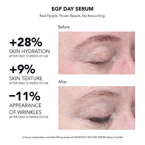 bioeffect egf day serum