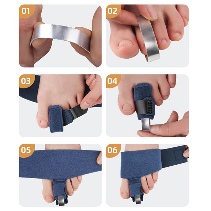 Finger%20Toe%20Straightener%20Toe%20Splint%20Corrector%20Toe%20Wrap%20For%20Hammer%20Toe%20Bent%20Claw%20And%20Crooked%20Toe%20To%20Align%20Support%20Toes%20Foot%20Care%20-%20Image%205