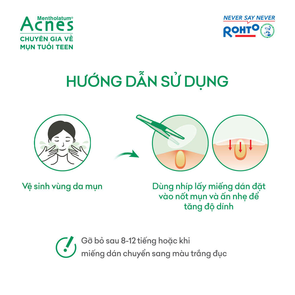 Acnes Clear Patch Helps Reduce Acne and Inflammation (48 Pieces)