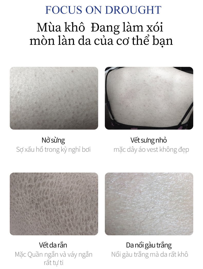 Kem body siêu trắng, kem trộn trắng da body 300g, Da khô, dưỡng ẩm, làm trắng da mềm mại, giảm sản sinh sắc tố đen, loại bỏ da chết, giữ mùi lâu