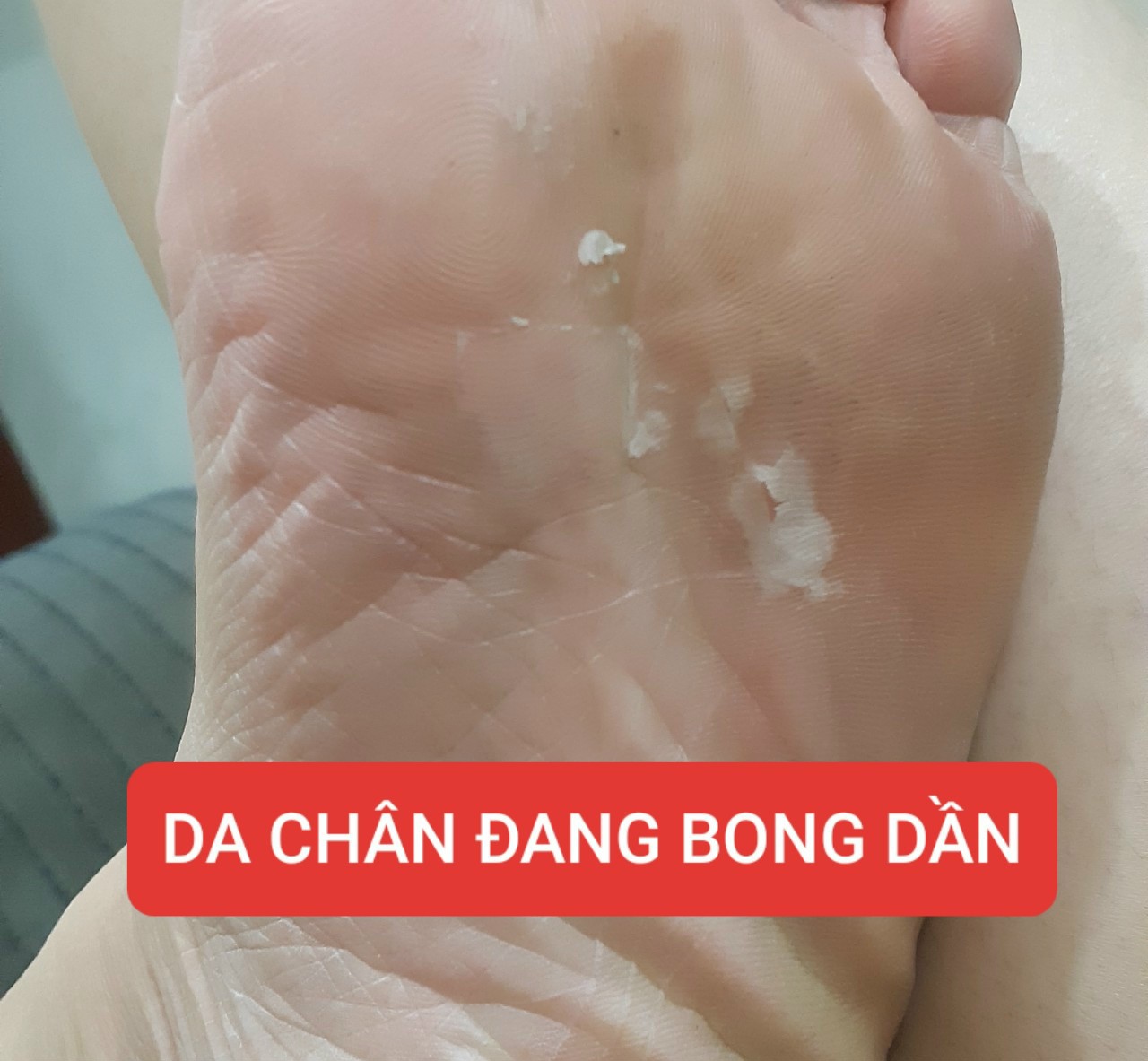 ủ chân lột da chết  nhật