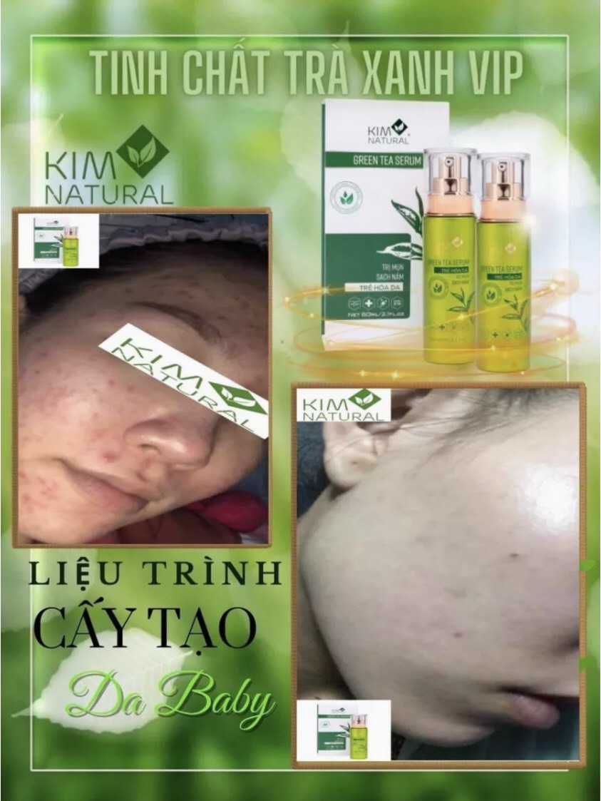 Tinh chất trà xanh vip