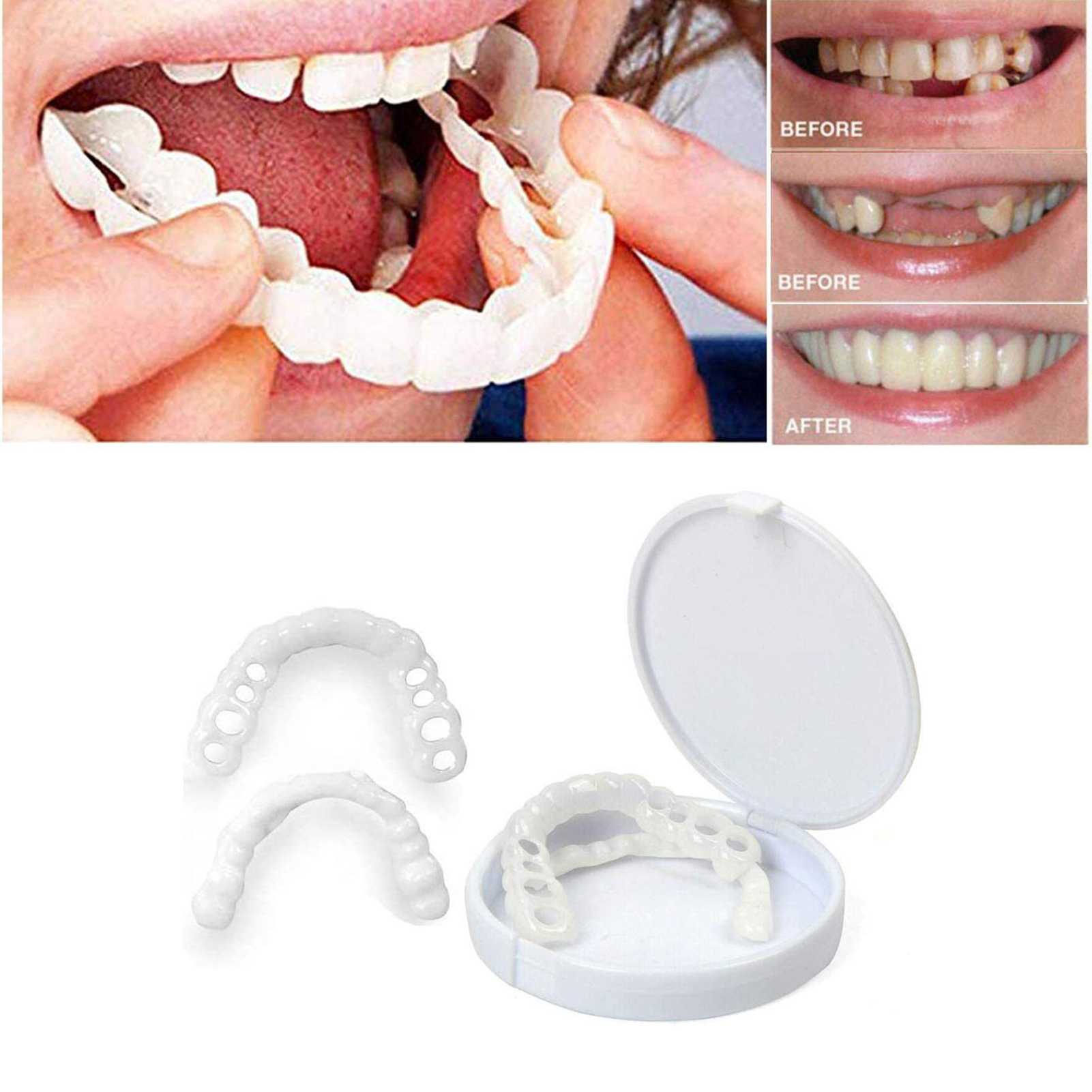 Orthopaedic Braces Tooth Orthotics False Shade Simulation Braces