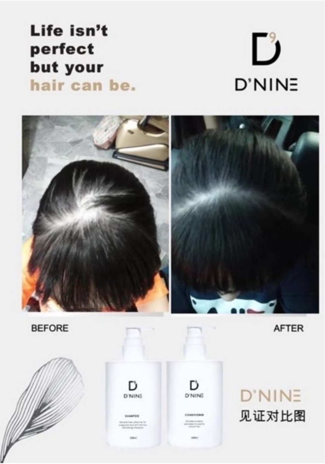 Dnine Oil Control Shampoo Conditioner Set Sg Main Distributor Lazada Singapore